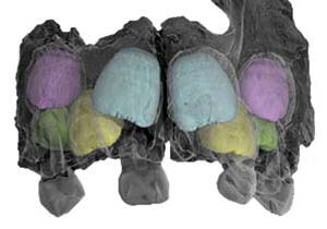 Tomografía computada del maxilar fosilizado de un Homo neanderthalensis infantil encontrado en Bélgica. En color se indican los dientes permanentes que no habían emergido del maxilar en el momento de la muerte. La pieza mide 4,3cm en sentido horizontal. Imagen tomada de Smith et al., 2010, PNAS 49: 20923-20928.  
