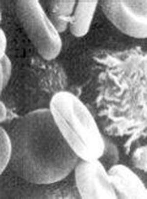 Microscopía electrónica de barrido de células de sangre humana. Los discos bicóncavos son glóbulos rojos; las otras células son leucocitos.