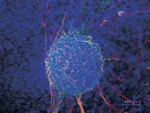 Células madre reprogramadas humanas en proceso de diferenciación. Color azul: núcleos celulares; colores verde y rojo: marcadores de ectodermo. Imagen Verónica Cavaliere Candedo.