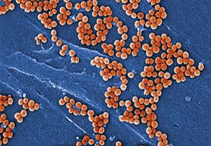 Imagen de microscopia electrónica de barrido de la bacteria Staphylococcus aureus resistente a la meticilina, en la actualidad uno de los microorganismos con mayor resistencia a antibióticos. Foto Wikimedia Commons