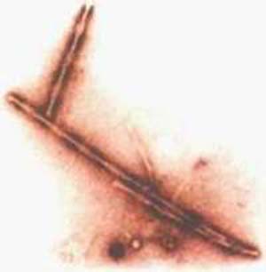 Fig. 2 : Filamentos helicoidales apareados, extraídos de neuronas de un cerebro humano con enfermedad de Alzheimer, vistos al microscopio electrónico (Aumento: 80.000x)